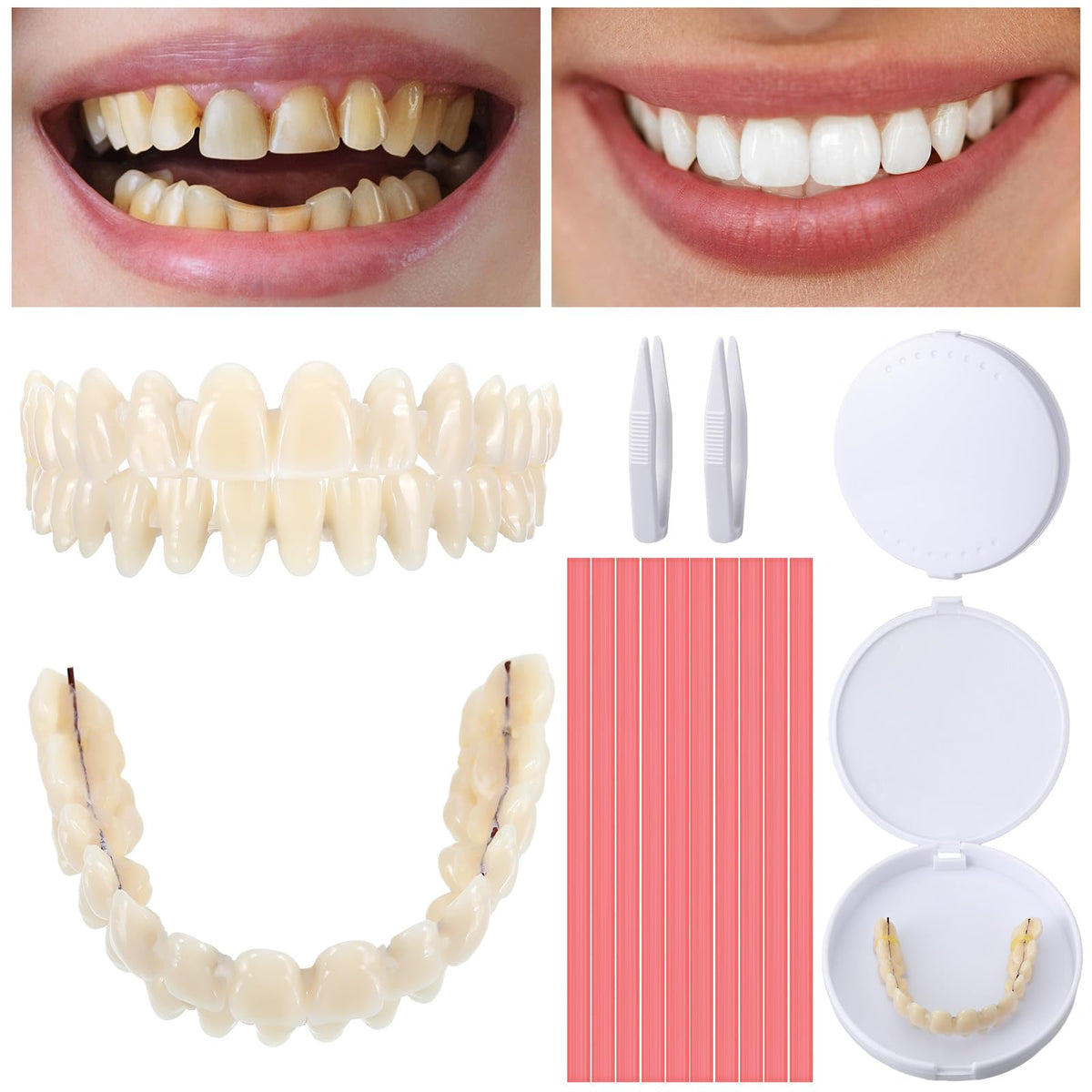 16 Pcs Dentures DIY Repair Kit H478245